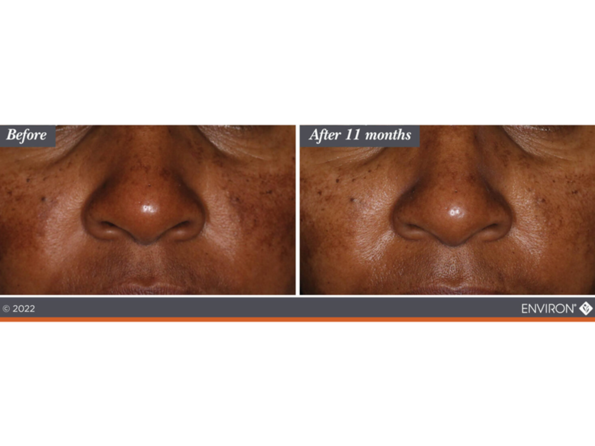 SKIN BY JACQUELINE