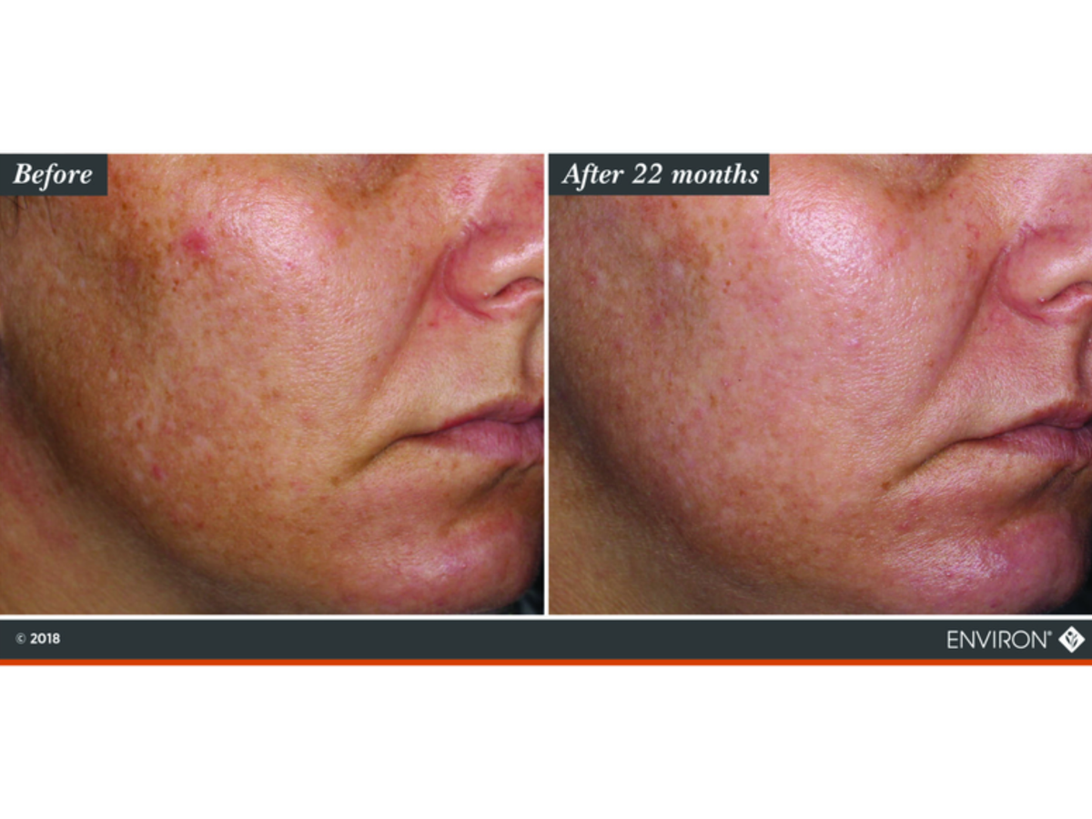 SKIN BY JACQUELINE