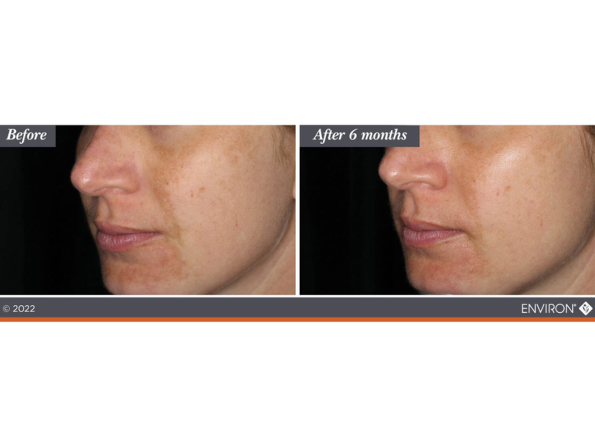 SKIN BY JACQUELINE