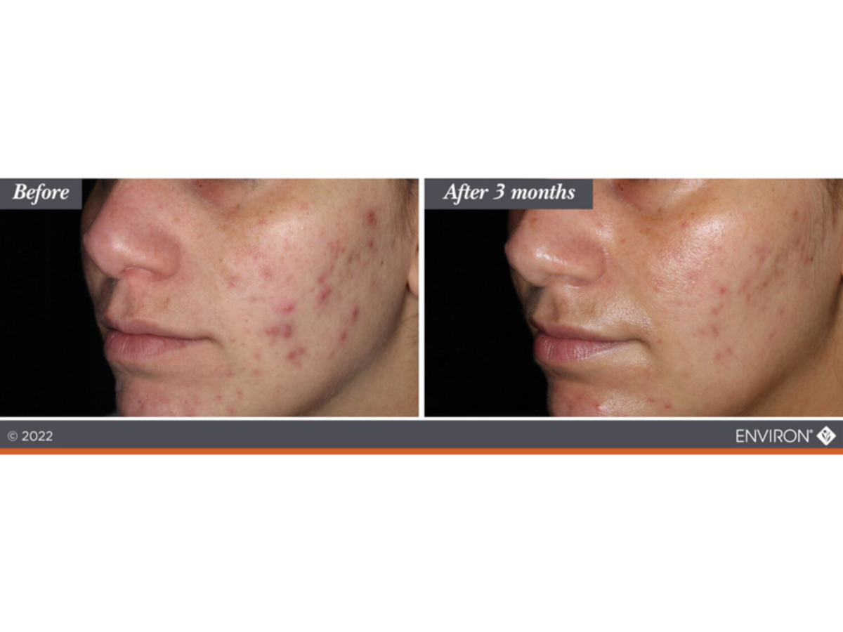 SKIN BY JACQUELINE